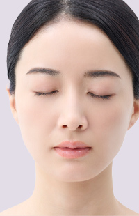 その他・顔のパーツの整形